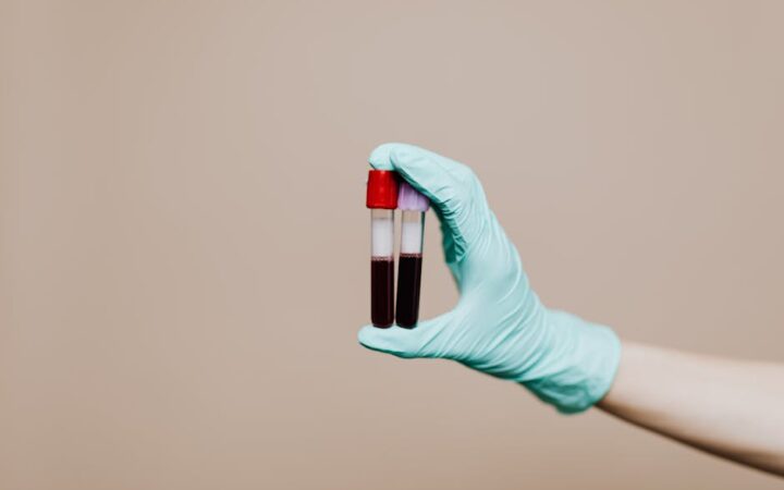 Why Personalized Nutrition is the Future of Health